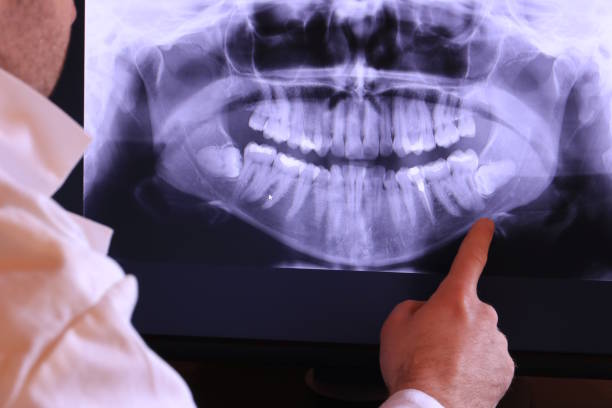 Best Emergency Root Canal Treatment in La Cygne, KS